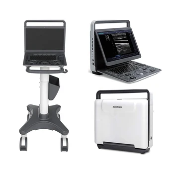 Portatil Sonoscape E2 ultrahang hordozható színes Doppler ultrahang gép Orvosi ultrahang műszerek ecografia E2 Sonoscape