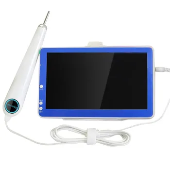 7 hüvelykes LCD kijelző 3,9 mm-es HD fültávcsőtisztító vizuális otoszkóp fülpiszkáló endoszkóp fülzsír eltávolító kamera
